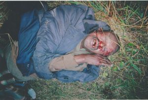 AIDS-KILLS-300x203 Man suffers from AIDS. Kelly Kosky Ministries
